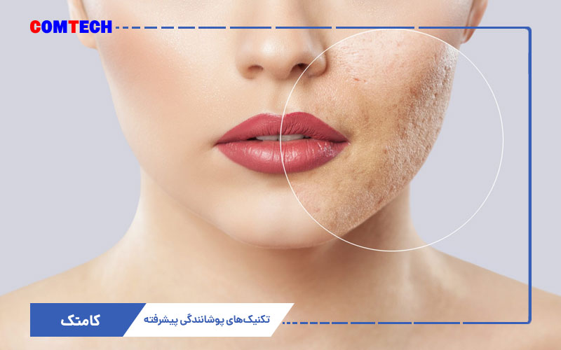 تکنیک پوشانندگی عیوب پوستی تکنیک پوشانندگی عیوب پوستی